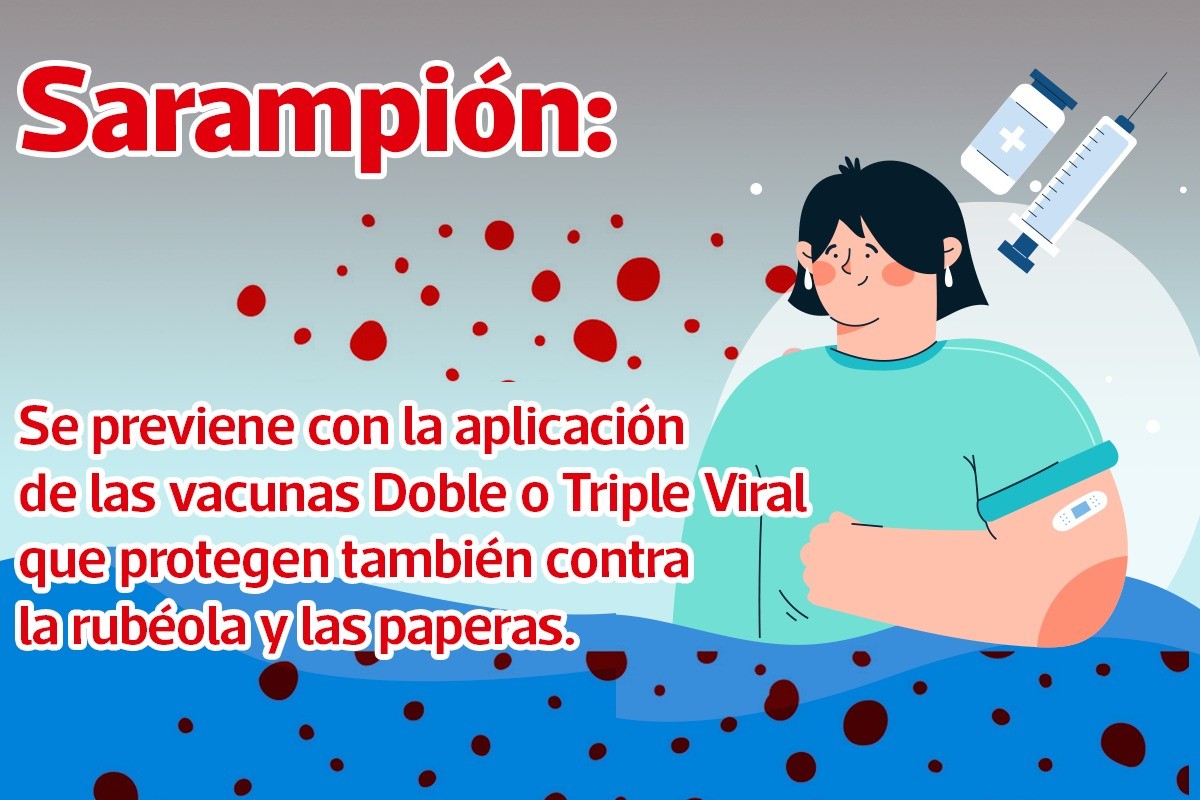 SARAMPIÓN: SOBRE LAS VACUNAS QUE PREVIENEN LA ENFERMEDAD